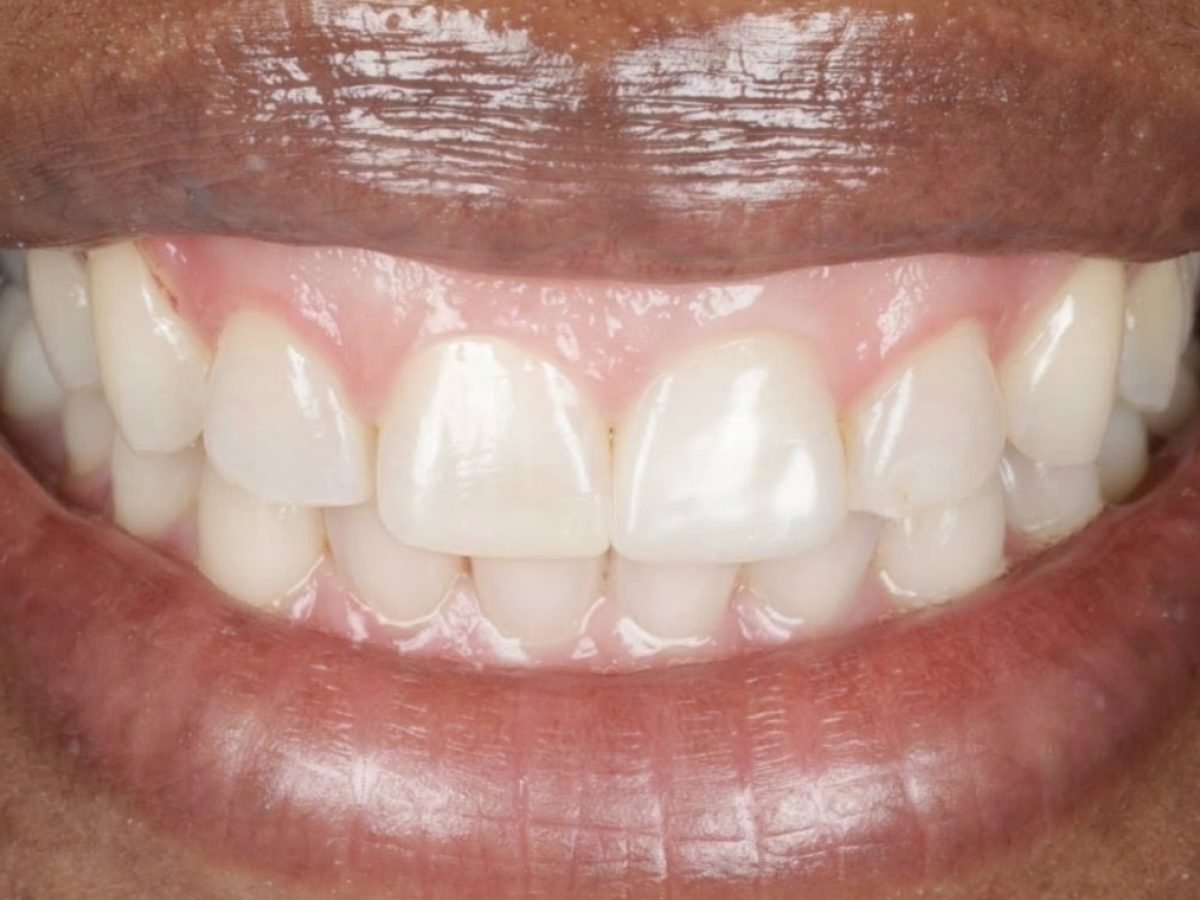 before treatment, case 1