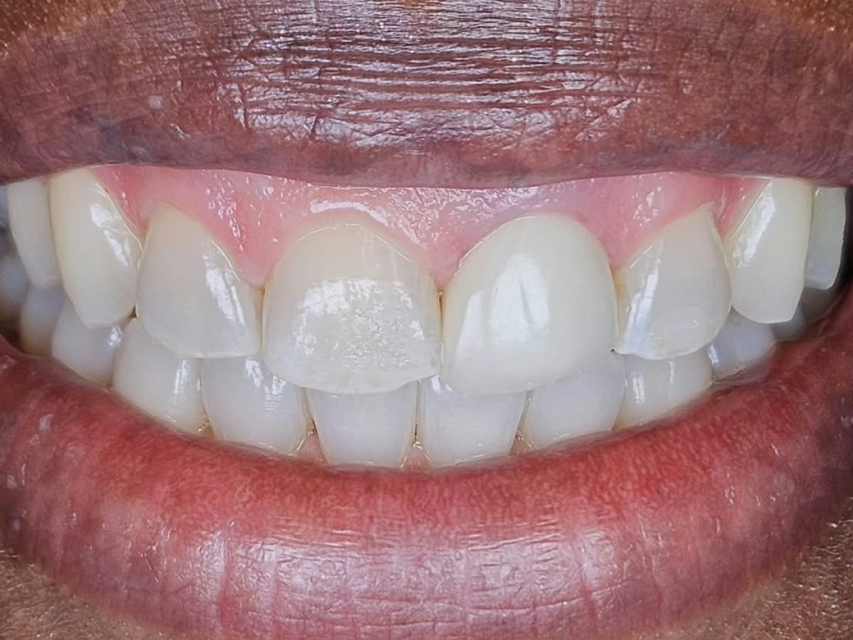 after treatment, case 1