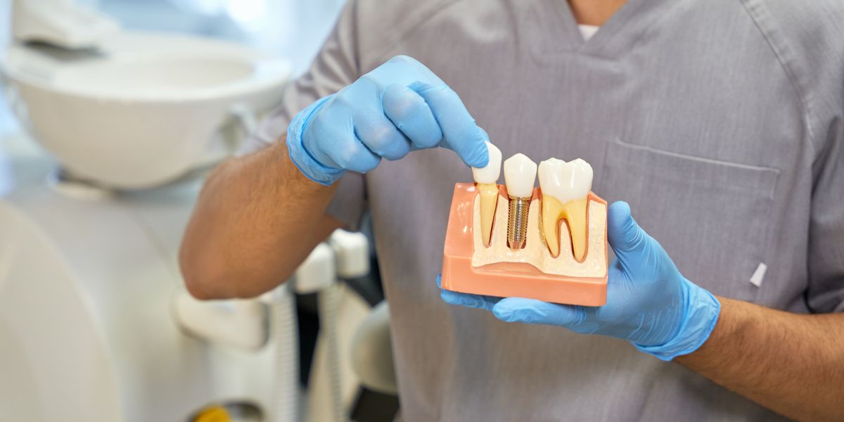 Exploring the different types of dental implants: which one is right for you?