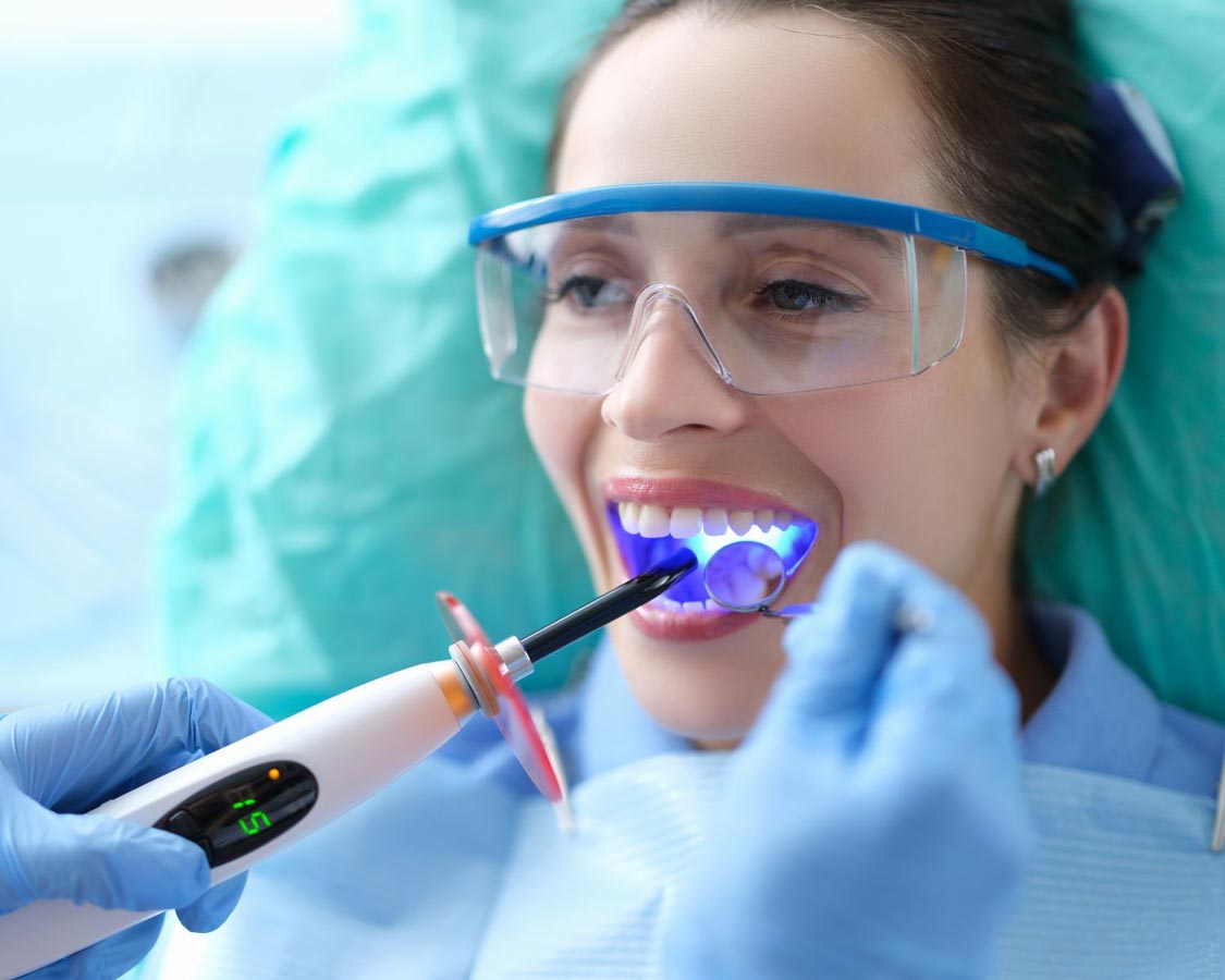 Dental Fillings